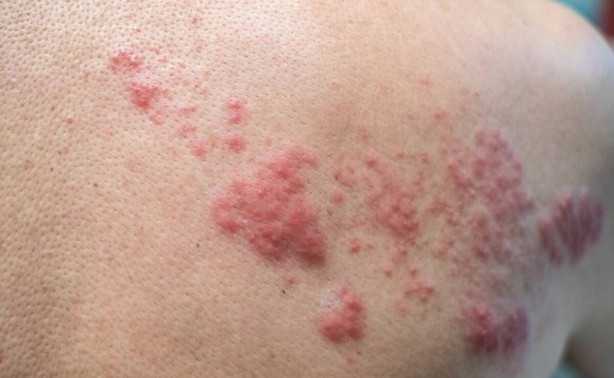 Enfermedades, desinversión y