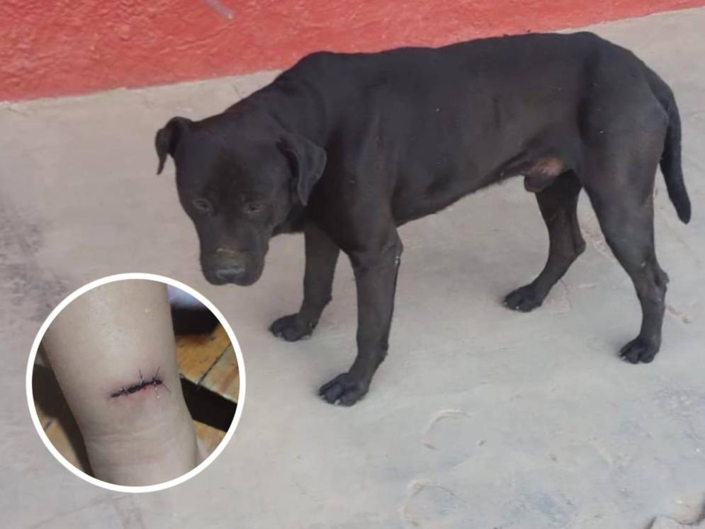 El perro de la mordedura y la herida en la pierna de la nena.