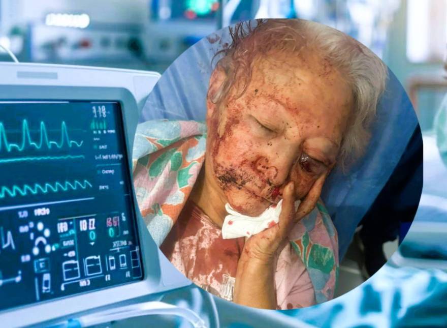 El crítico estado de salud de la abuela golpeada en el robo de Los Aromos