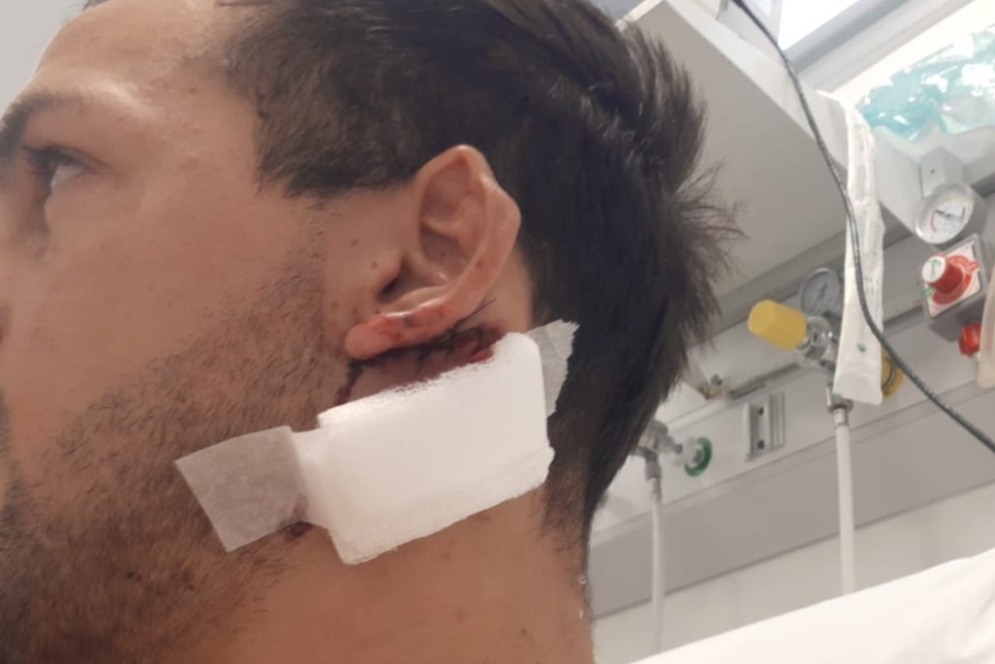 El corte habría sido originado con un elemento filoso, pero no con un cuchillo. 